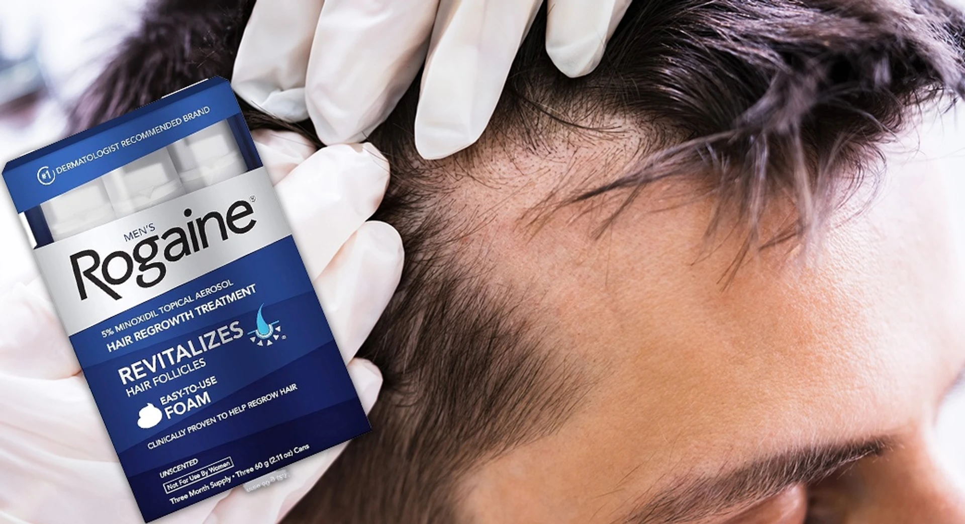 Finasterid vs Minoxidil: Saç dökülmesine karşı tedavilerin karşılaştırması