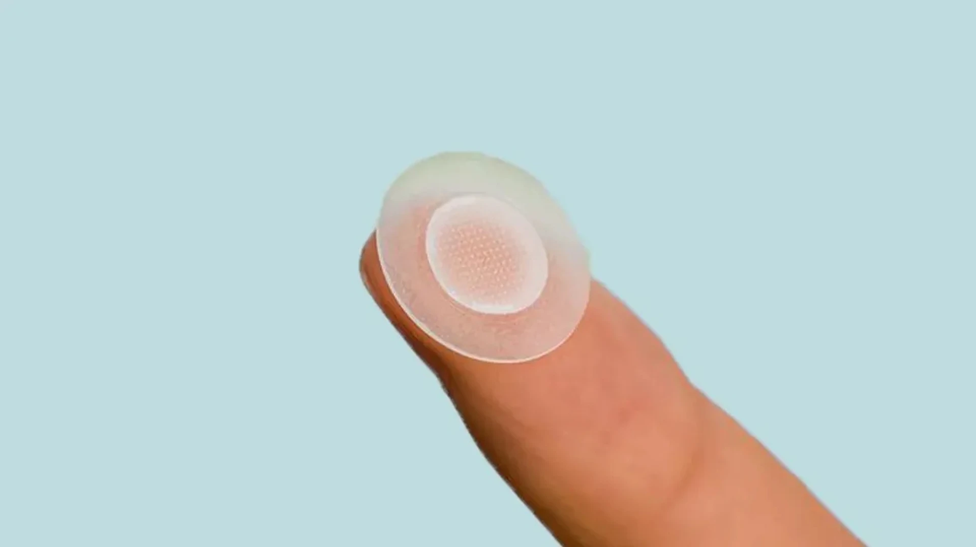 Sivilce bantları – akne bantları ne kadar etkili?