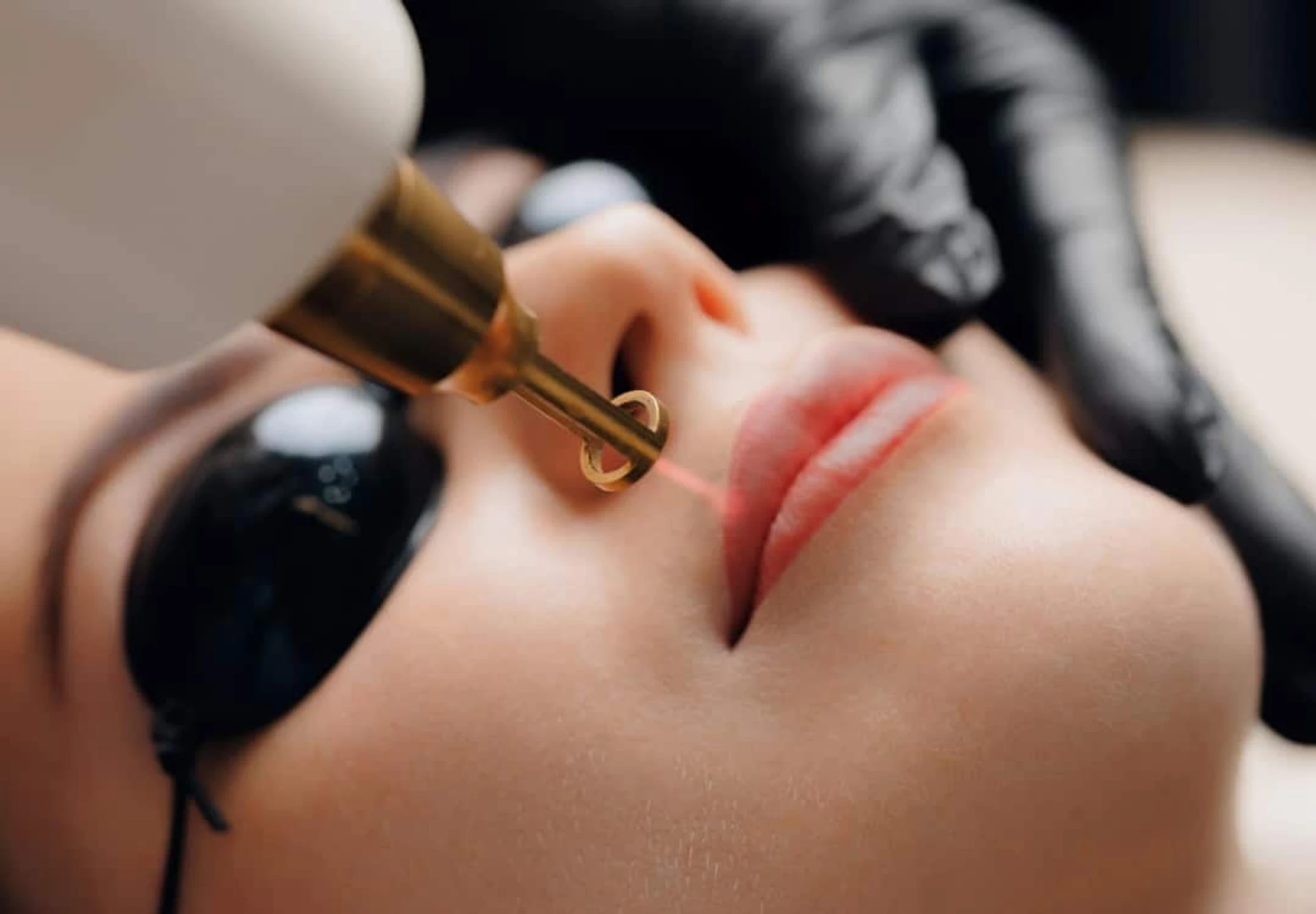 Dudak hiperpigmentasyonunun nedenleri ve koyu dudakların tedavisi