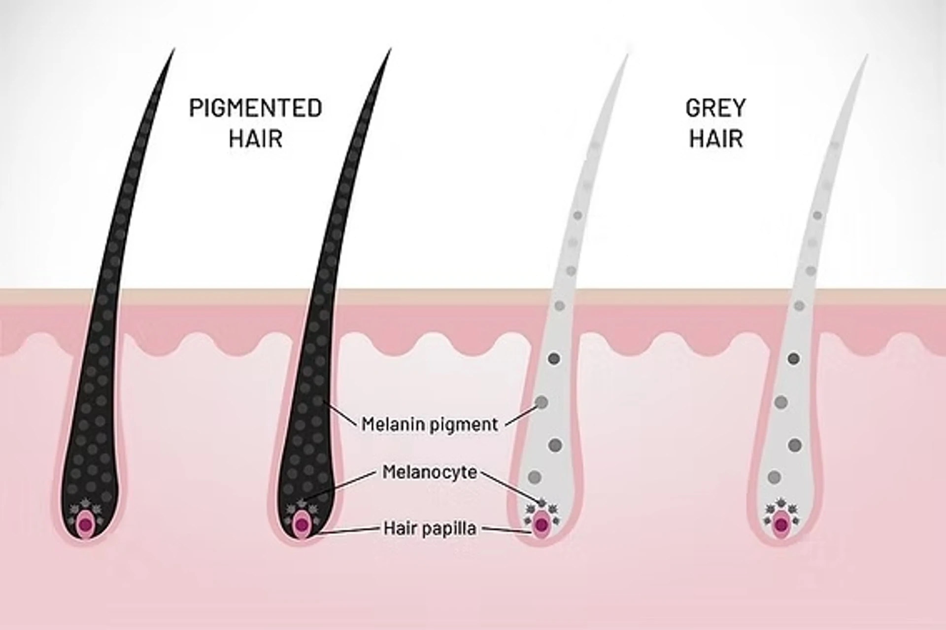 Beyaz saçlar: Nedenleri ve bakım önerileri