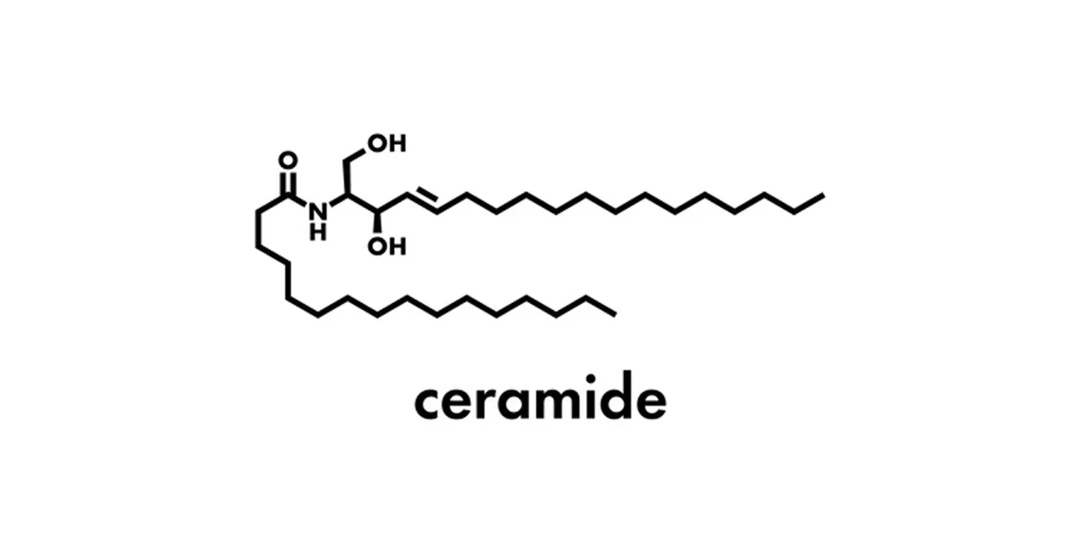 Seramikler
