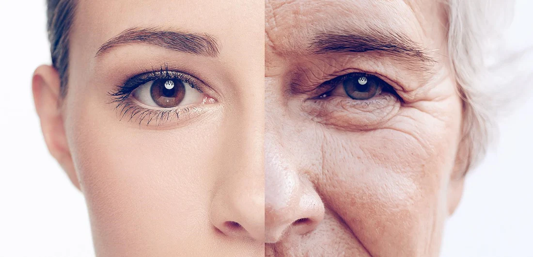 Cilt yaşlanması / Anti-aging