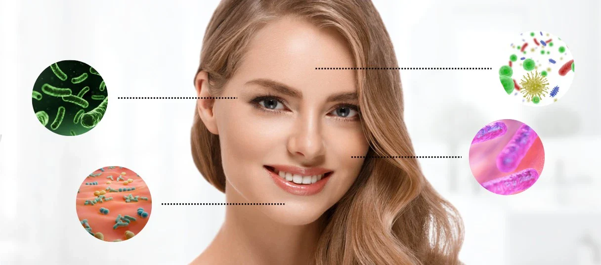 Rosacea tedavisinde probiyotiklerin faydaları