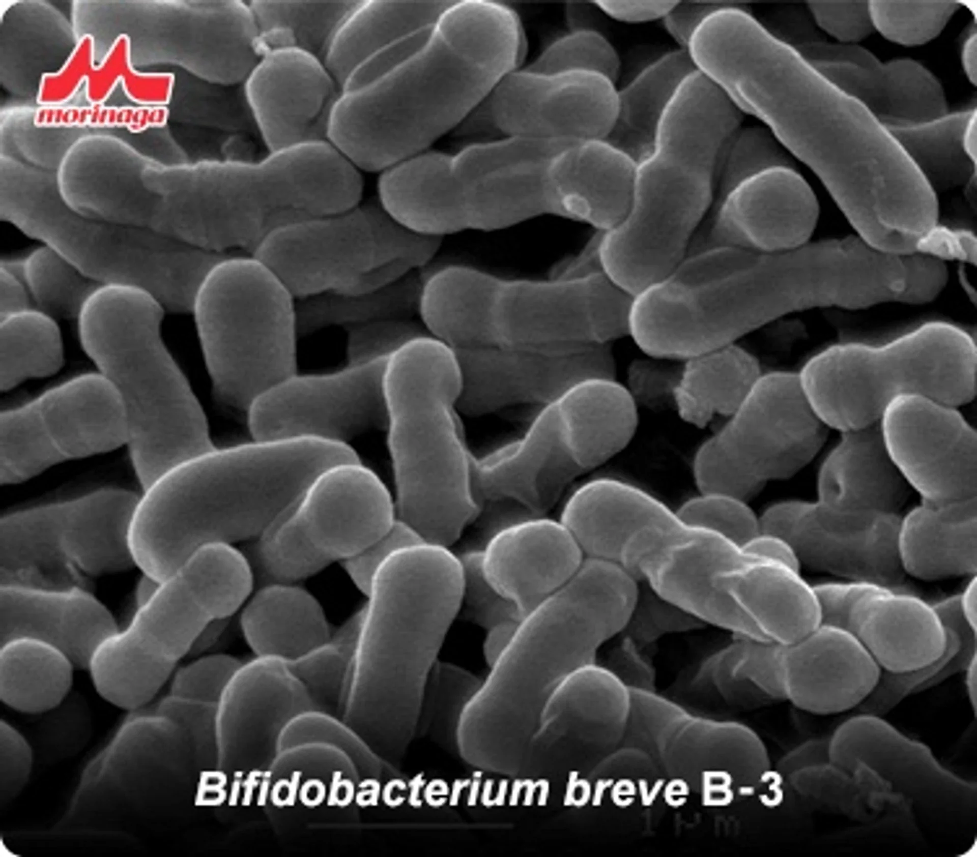 Rosacea tedavisinde probiyotiklerin faydaları