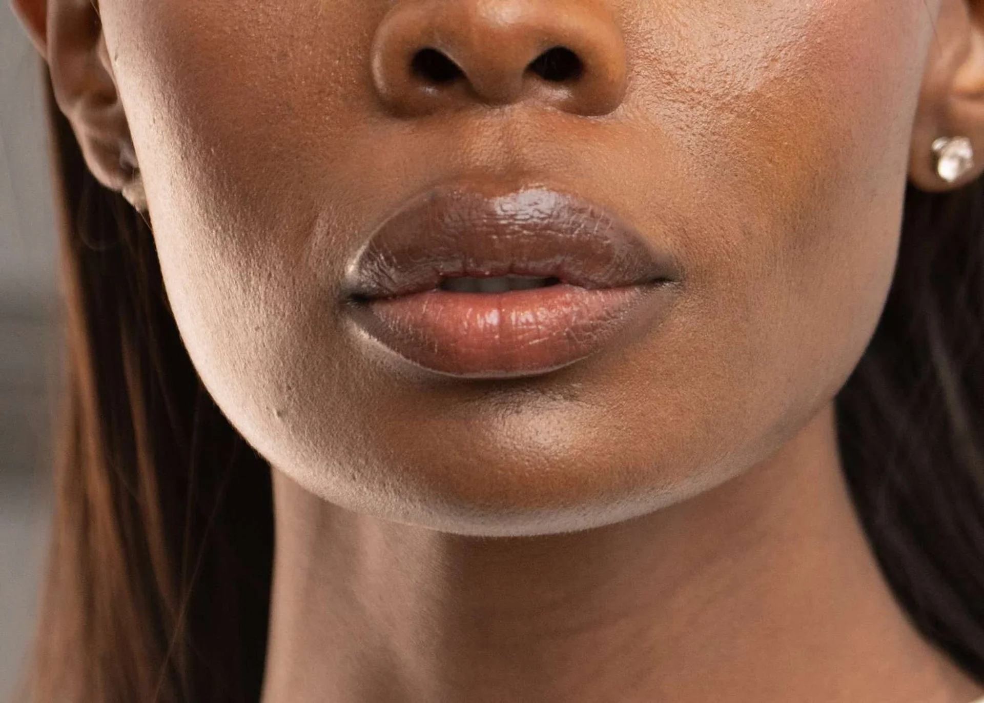 Dudak hiperpigmentasyonunun nedenleri ve koyu dudakların tedavisi
